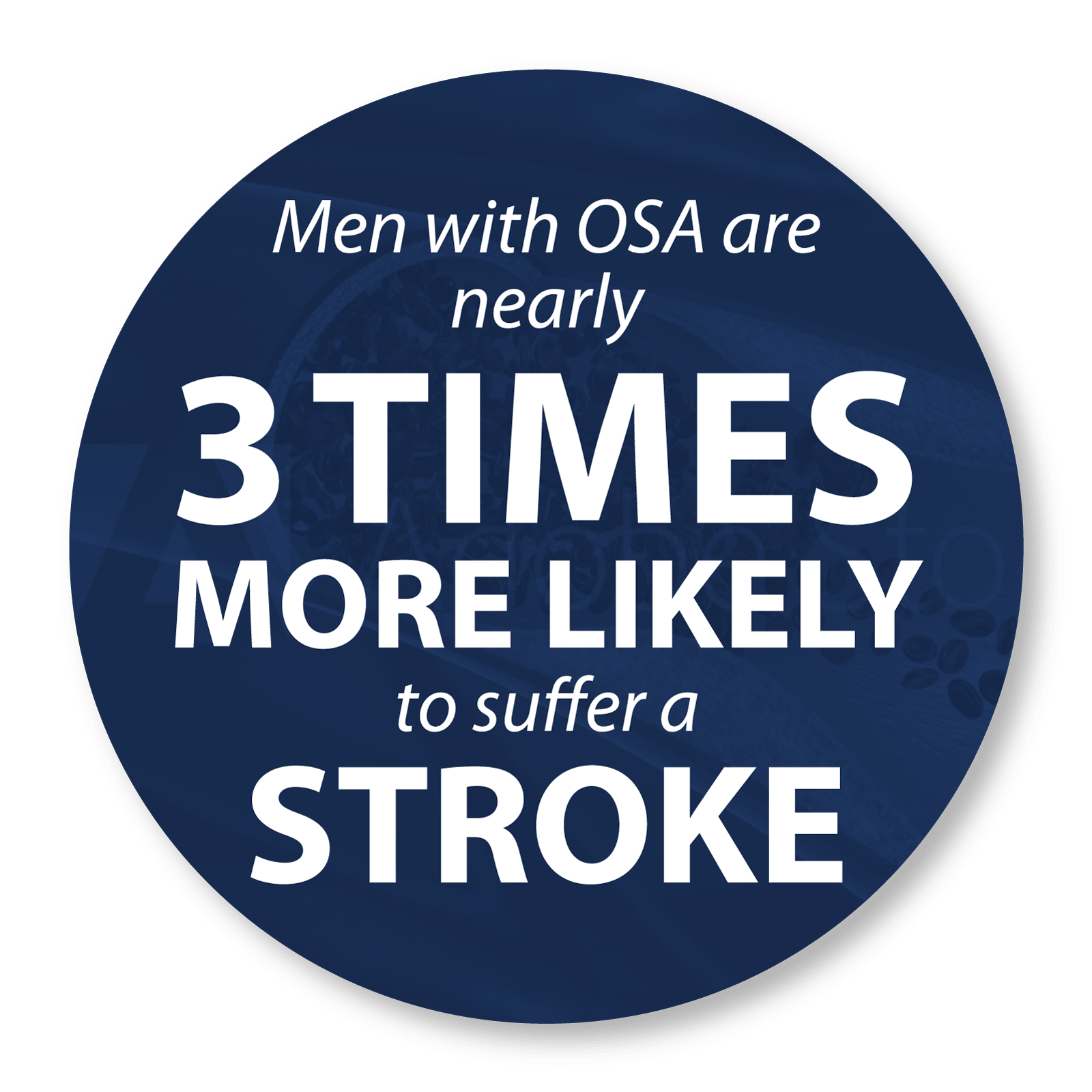 Stroke Statistics