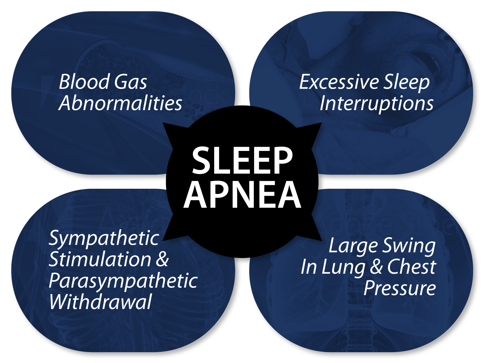 Cardiovascular Consequences of Sleep Apnea