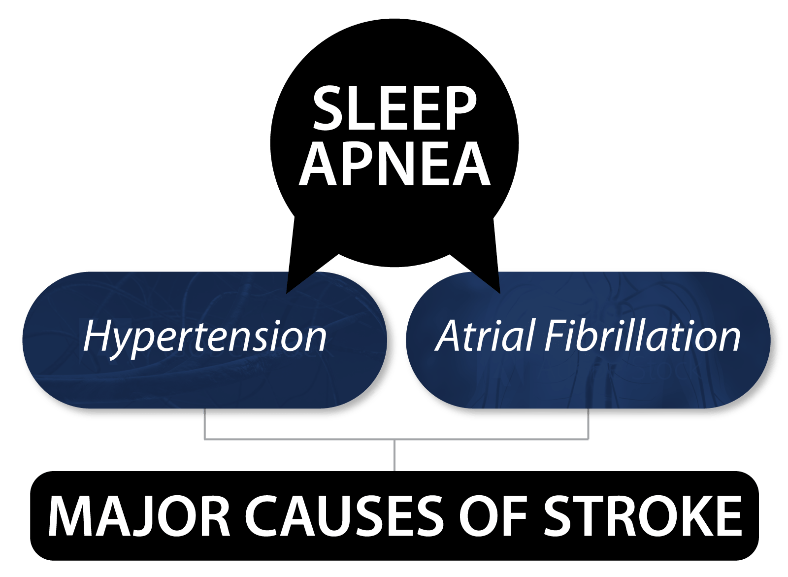 Stroke Main Symptoms